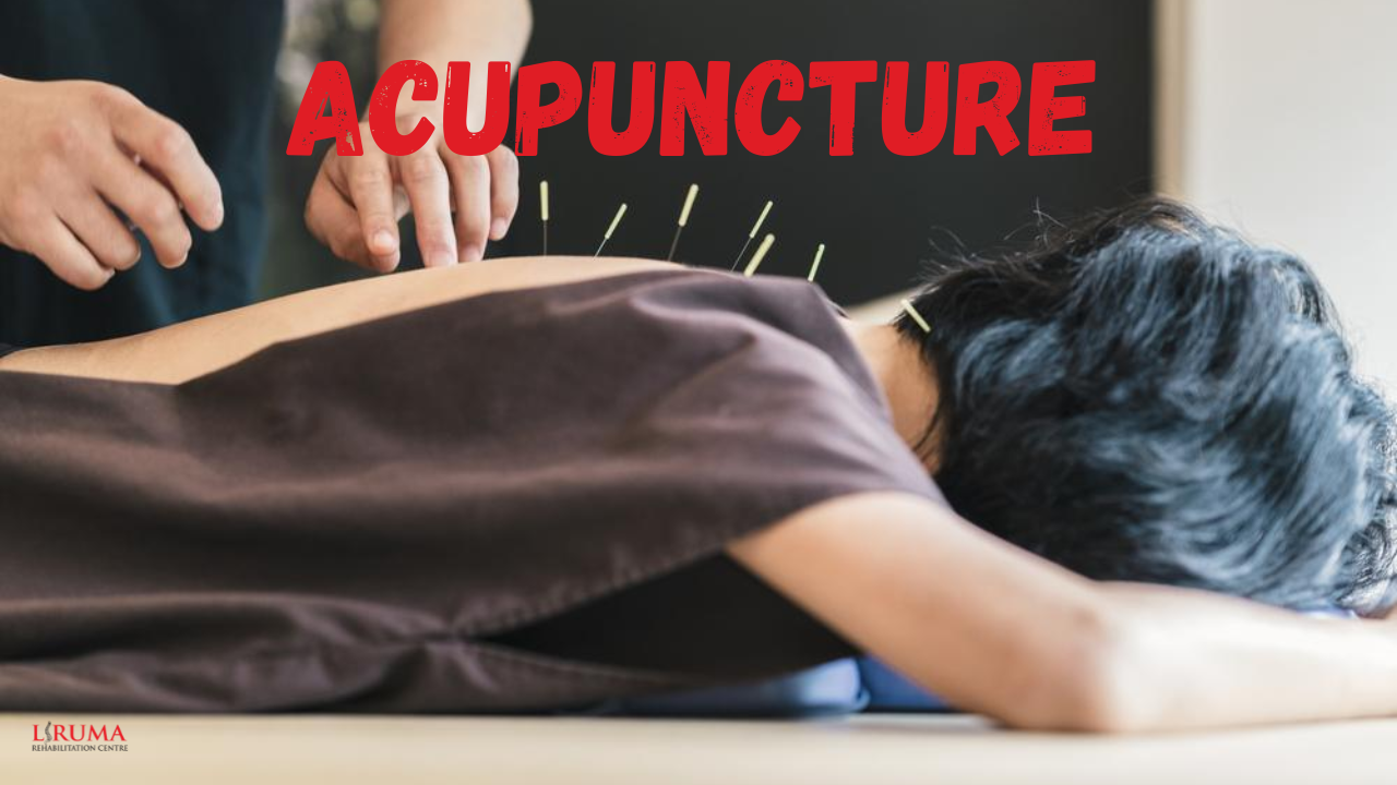 acupuncture